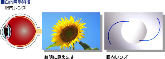 治療方法